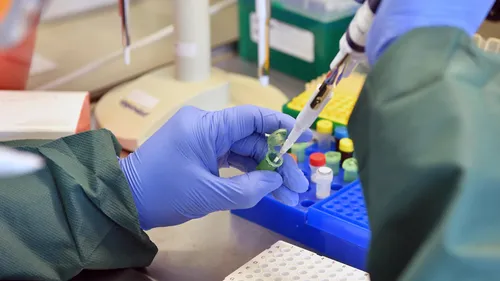 La circulation du COVID-19 en hausse dans les Pays de la Loire